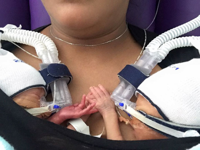 Premature birth twins hold hands babies anthea jackson rushford 2.jpg