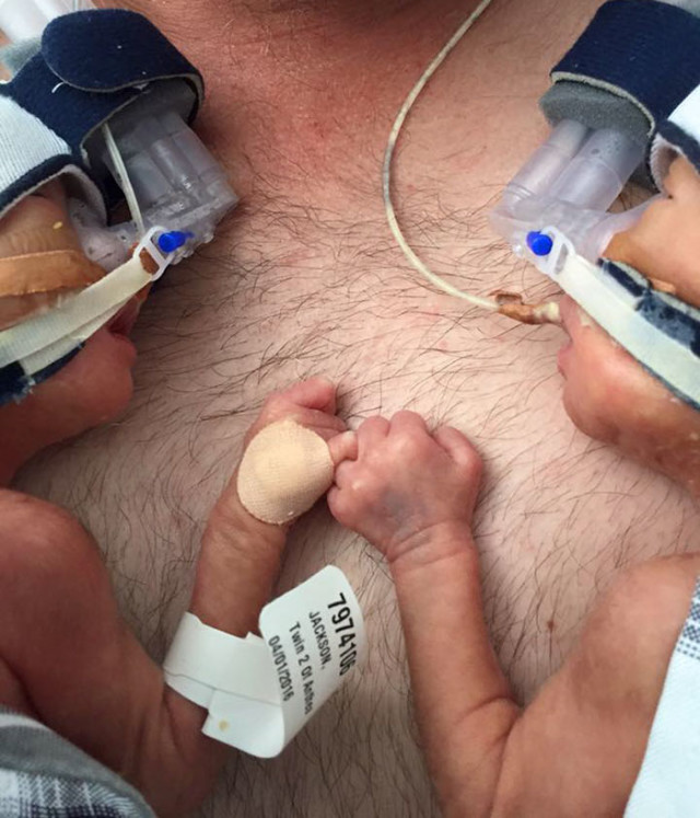 Premature birth twins hold hands babies anthea jackson rushford 4.jpg