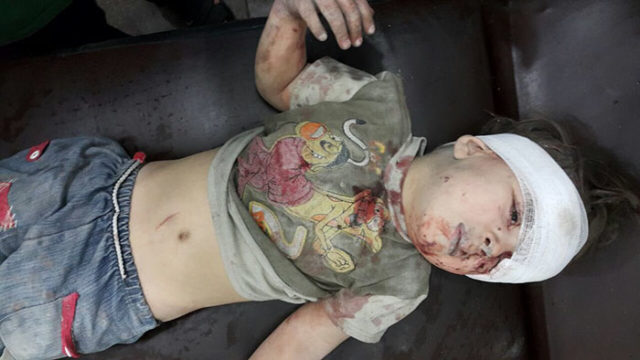 Alleppo boy air strike syria omran daqneesh 1.jpg