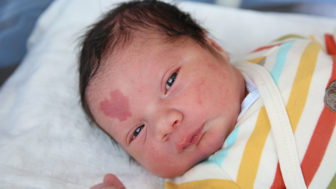 Heart shaped birthmark baby turkey 1.jpg