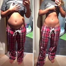Before after posture instagram body photos 1 58c10954650b6__700.jpg