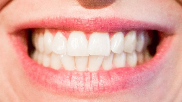 Prirodzene biele zuby a žiarivý úsmev.