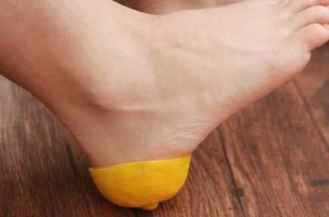 How to get rid of calluses on feet 4.jpg