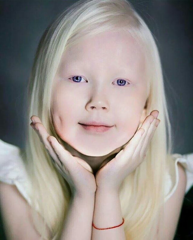 Albino girl snow white nariyana siberia 11.jpg