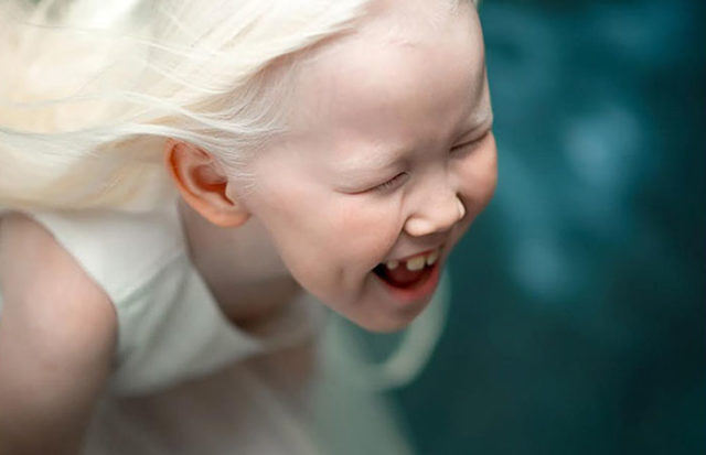 Albino girl snow white nariyana siberia 2.jpg