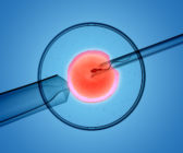 3D rendering of the icsi(intracytoplasmic sperm injection) process - in which a single sperm is injected directly into an egg