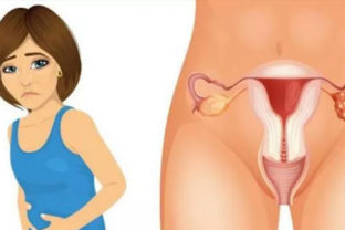 4 skoré príznaky rakoviny vaječníkov, o ktorých by mala vedieť každá žena