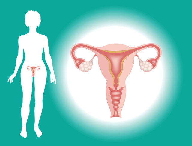 Vaječníky, rakovina vaječníkov, ženské pohlavné orgány