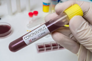 Krv testovanie koronavirus