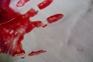 Krv ruka zranenie