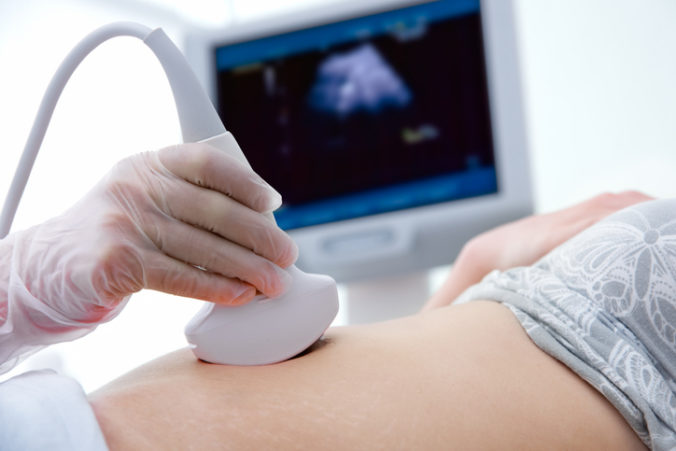 ultrazvuk, potrat