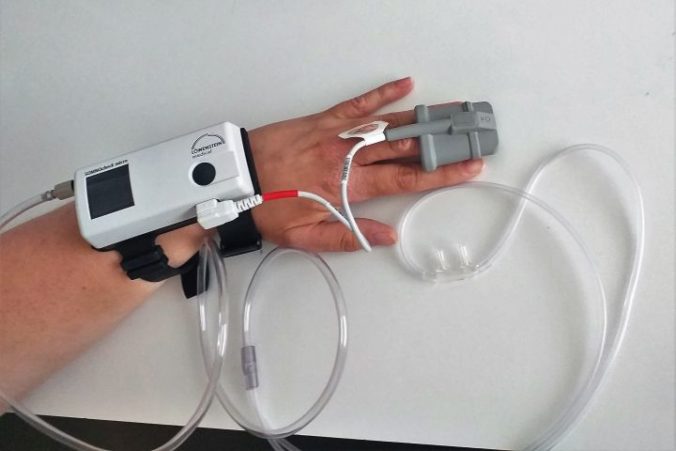 Nový prístroj pomôže v banskobystrickej nemocnici pacientom s cystickou fibrózou