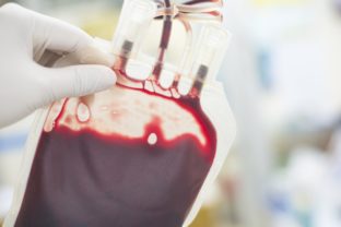 Krv, transfúzia krvi