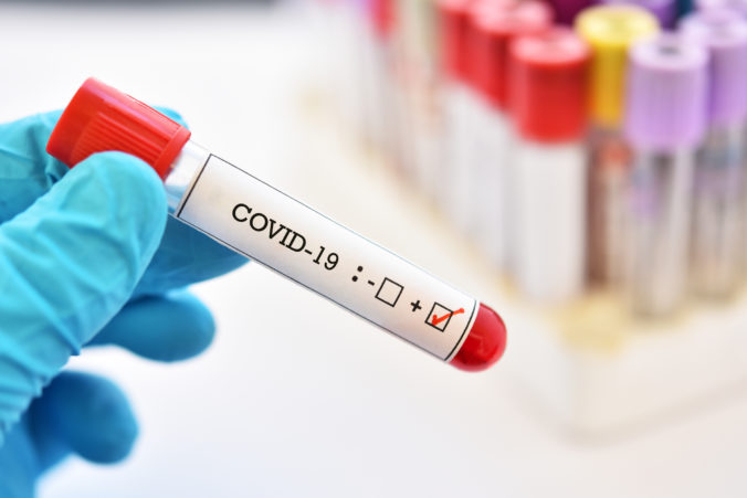 Blood sample tube positive with COVID 19
