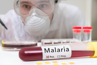 Malaria, test