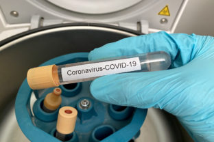 Koronavírus, covid 19, laboratórium