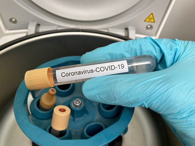 Koronavírus, covid 19, laboratórium