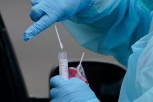 PCR testy potvrdili 3 269 ľudí  novoinfikovaných na koronavírus.