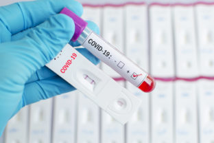Pozitívny test, koronavírus