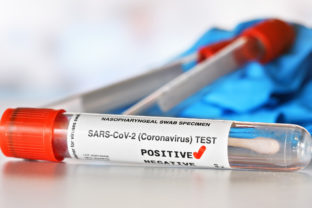 Pozitívny test, koronavírus
