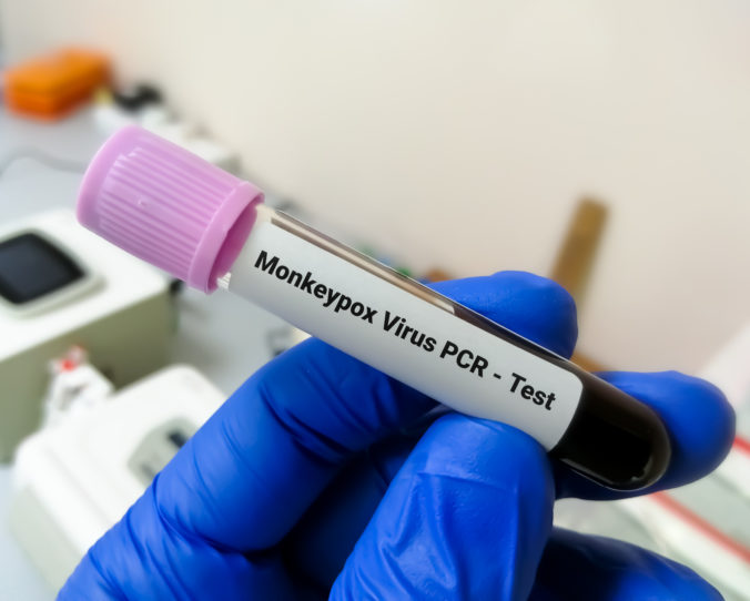 PCR test na opičie kiahne
