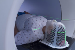 Woman Receiving a Medical Scan for Cancer Diagnosis