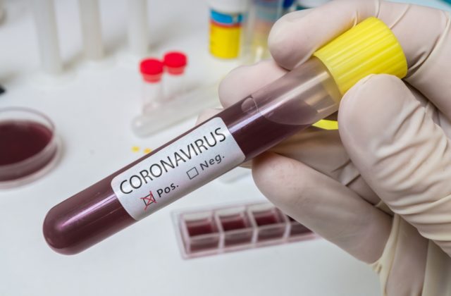 Vyšetrovanie pôvodu koronavírusu je v kritickom bode, dostalo sa do slepej uličky