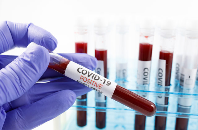 V Poľsku za deň pribudlo rekordné množstvo pozitívne testovaných na koronavírus
