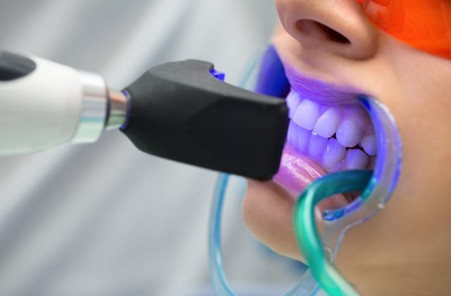 Bielite si zuby? Úrad verejného zdravotníctva varuje pred týmito výrobkami