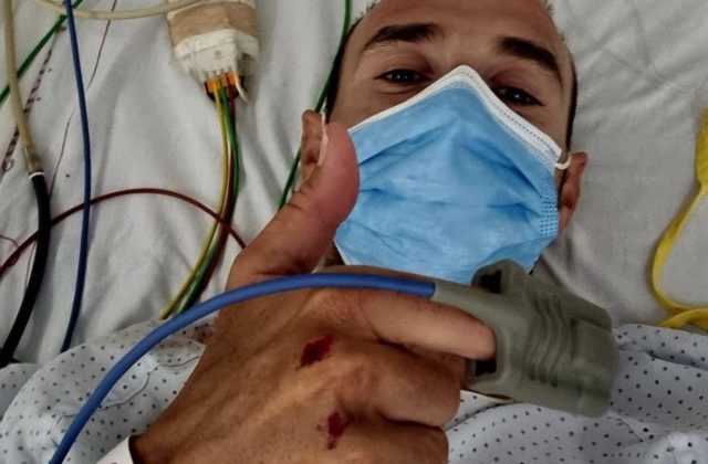 Španielskeho cyklistu Valverdeho zrazilo auto počas tréningu, vodič z miesta nehody ušiel