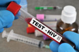 AIDS hiv test