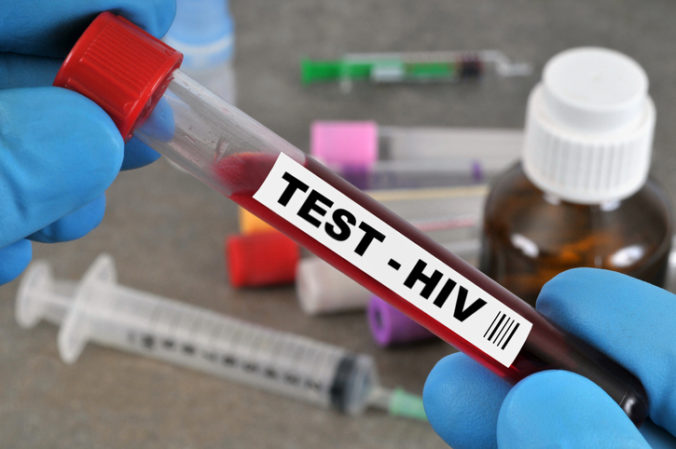 AIDS hiv test