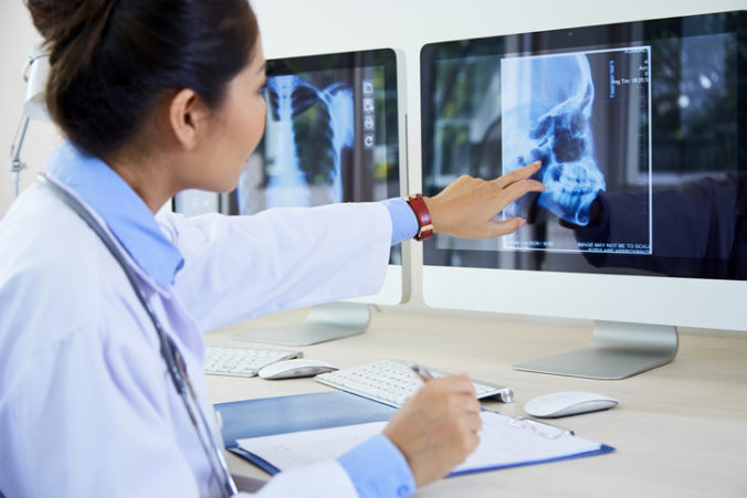 rádiológ röntgenový prístroj ultrazvuk Rtg snímky, CT, MR, mamografické vyšetrenie